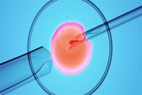 招聘“代孕妈妈”非法代孕